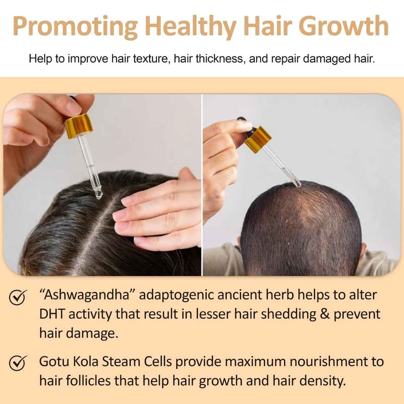Ultra Restore Hair Growth Serum, DHT Blocker Reduce Hair Loss