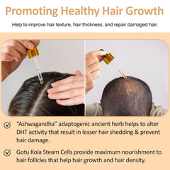 Nirvana Nurture Ultra Restore hair growth serum, scalp serum, detox scalp, nourish hair hair follicle, boost hair growth & reduce hair loss gift for her ultra restore hair growth serum  Gotu Kola Stem Cells, Biotin, Keratin, Ashwagandha, Amino Acids, Collagen, Niacinamide, Onion, Argan, and Caffeine